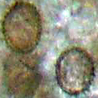 sporentype A